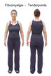 © agenturfotografin - Fibromyalgie Tender Points Tenderpoints Frau
