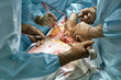 © Andriy Bezuglov - Abdominal operation process