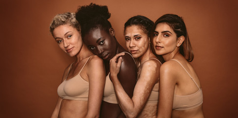 Wall Mural - multi ethnic female friends standing together