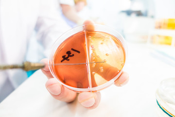 Wall Mural - sowing biological culture on agar in a Petri dish