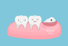 Wisdom Teeth Illustration.