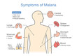 Illustration showing Malaria transmission cycle. Step of infections in people with mosquito.
