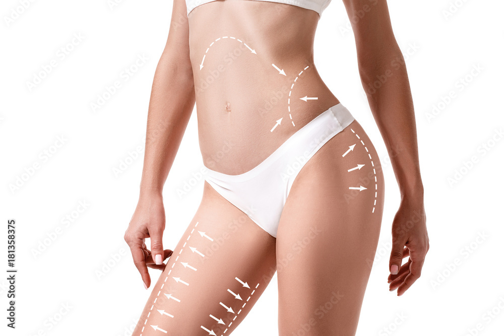Female body with the drawing arrows on it isolated on white. Fat lose, liposuction and cellulite removal concept. - obrazy, fototapety, plakaty 