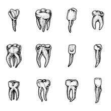 Molar Teeth Enamel, Dental Set. Work Of The Dentist And Care For Children. Oral Cavity Clean Or Dirty. Health Or Caries Human. Engraved Hand Drawn In Old Sketch, Vintage Style. Symbol Of Medicine.