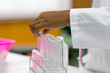 © sinhyu - Experiment chemical of urine in the laboratory.