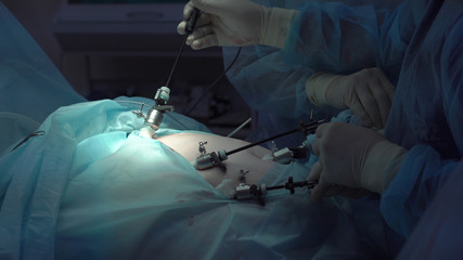 Operation using laparoscopic equipment. Surgeons team. Hospital.