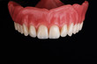 upper part of denture, removed on a black background