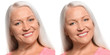 Mature woman before and after biorevitalization procedure on white background