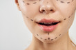 © SHOTPRIME STUDIO - Face, contour for operation, plastic surgery, mouth, smile, woman