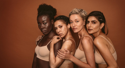 Wall Mural - young women with different skin types