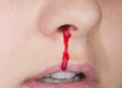 Bleeding through the nose of a woman close up.