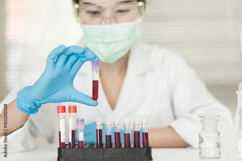 Female Technician holding blood tube test, a rack of blood samples ...