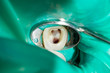 treatment of a sick tooth in dentistry close-up