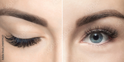 Fotografia  Eyelash removal procedure close up