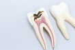  Tooth model for classroom education and in laboratory.