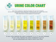 Urine Color Chart 1