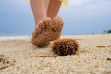 A Man Walks Along The Beach And Is About To Step On A Poisonous Sea Urchin. Danger On Vacation In A Tropical Country.