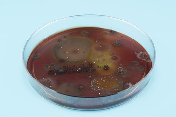 Wall Mural -  growth of microorganisms in a Petri dish, Bacteria, yeast and mold growing on an agar plate.