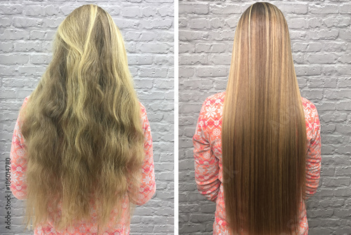 Sick Cut And Healthy Hair Hair Before And After Treatment Buy
