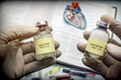 Doctor holds two vials of idarubicina and Oncaspar to inject, medicine used in acute lymphatic leukemia disease