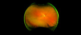 Fototapeta Las - eye's retinal angle image with macula, vessels and optic disc isolated view on a black bacground. made by ultra wide fundus camera