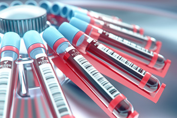 Wall Mural - Lab equipment centrifuging blood. Concept image of a blood test.3d rendering.