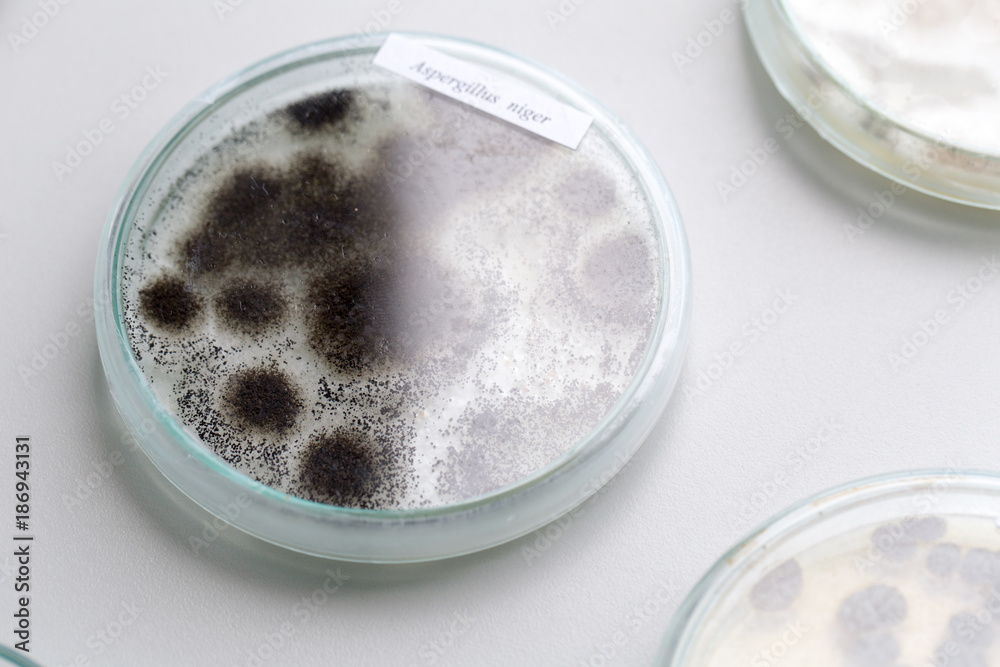 Asperillus niger in petri dish under the microscopic, Microbiology for ...