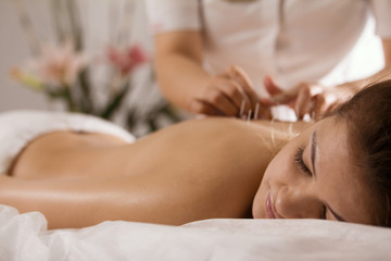 The doctor sticks needles into the girl's body on the acupuncture - close up