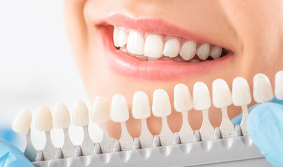 Wall Mural - Beautiful smile and white teeth of a young woman.