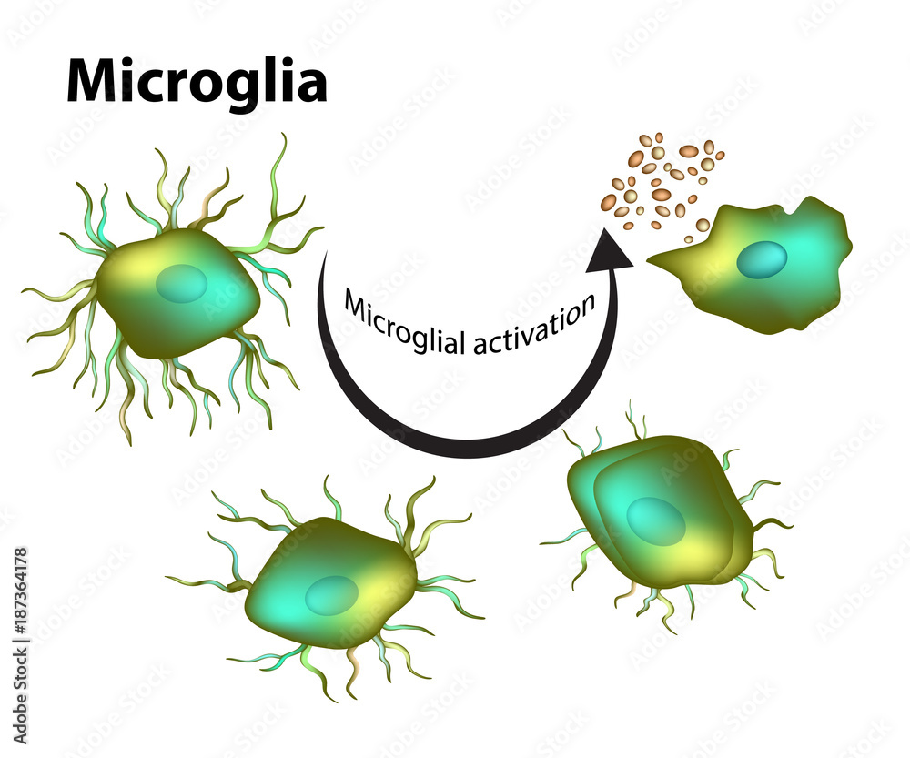 Activation of microglia. Stock Vector | Adobe Stock