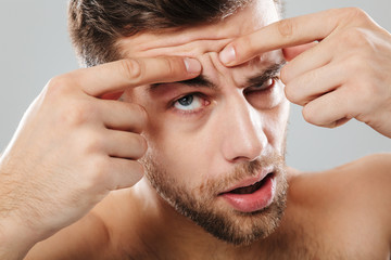 Wall Mural - Close up portrait of a man squeezing pimple