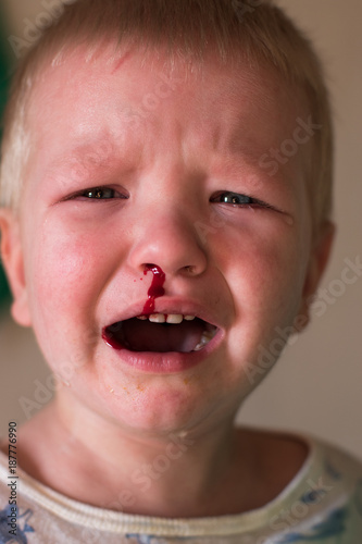 Sad Blood Drop Photos - Free & Royalty-Free Stock Photos from Dreamstime