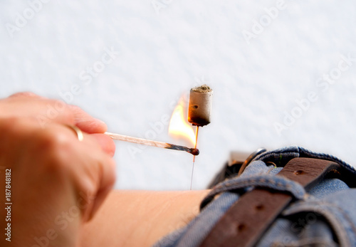 Fotografía Moxa Therapie, Moxibustion in der TCM, Beifußfasern werden mit Streicholz zum ve