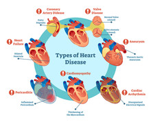 Types Of Heart Disease Collection, Vector Illustration Diagram. Educational Medical Information. 
