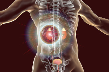 Sticker - Kidney pathology treatment and prevention concept, 3D illustration