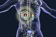 Adrenal glands pathology treatment and prevention concept, 3D illustration