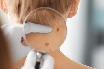 Wall Mural - Dermatologist examining birthmark of patient, closeup. Cancer concept