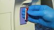 © Alex Traveler - Slide peripheral blood smear method. Doctor examines and analyzes blood samples in the laboratory