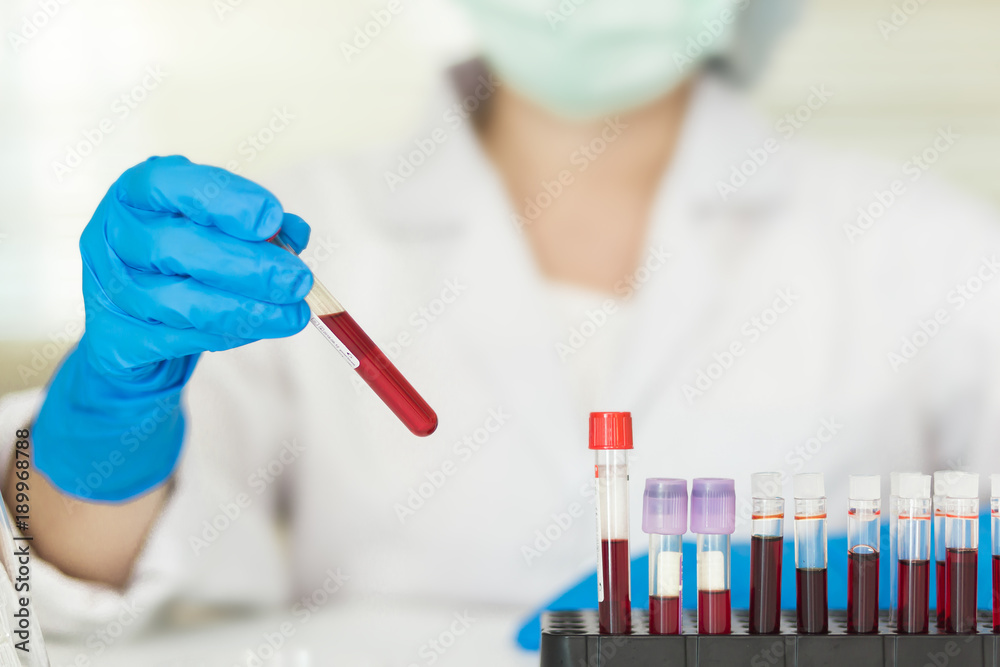 Female Technician holding blood tube test, a rack of blood samples ...