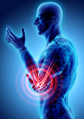 Wall Mural - 3d illustration of human elbow injury.