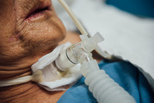 Patient Do Tracheostomy And Ventilator In Hospital