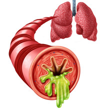 Bronchitis Anatomy Concept
