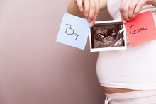Pregnant Woman Holding Ultrasound Scan And Blue And Red Post Its With Words Boy Or Girl