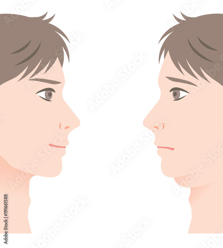 二重あご 男性 ビフォーアフター Buy This Stock Vector And Explore Similar Vectors At Adobe Stock Adobe Stock