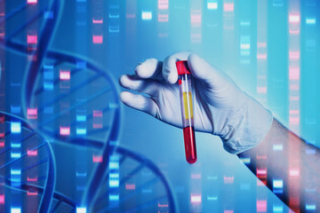 Wall Mural - Analysis of dnk. A hand in a medical glove holds a test tube with DNA. Spirals and blood molecules of DNA. Microbiological investigations of viral diseases.