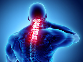 3d illustration, neck painful - cervical spine skeleton x-ray, medical concept.