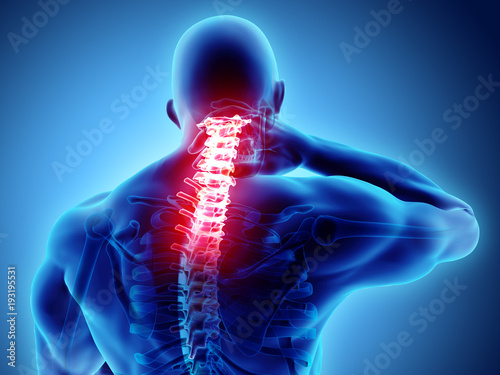 Fotomural 3D illustration, neck painful - cervical spine skeleton x-ray, medical concept