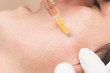© aerogondo - close up of a woman having mesotherapy treatment