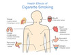 Diagram about health effect of cigarette smoking. Illustration about risk of smokers.
