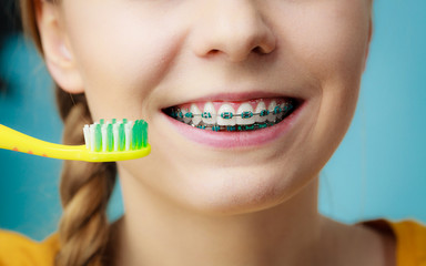 Wall Mural - Woman with teeth braces using brush